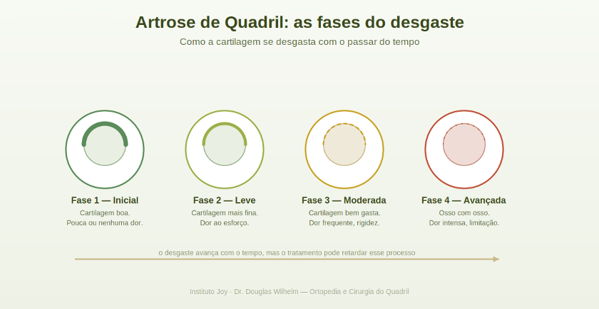 Diagrama das fases da artrose no quadril